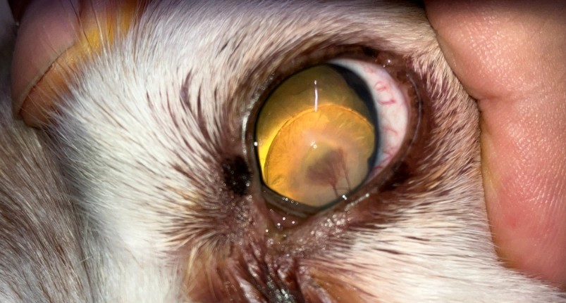 葡萄膜炎 康復期