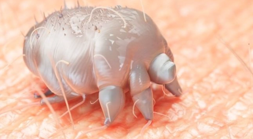 疥蟲感染原因 疥蟲感染原因