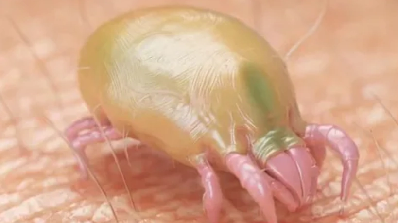 疥蟲怎麼來的？揭開疥瘡傳染途徑與預防關鍵