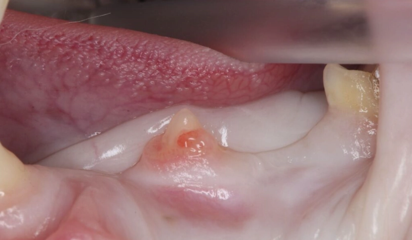 貓咪牙齒吸收症狀 貓咪牙齒吸收症狀