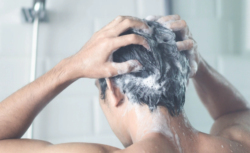 疥瘡可以洗澡嗎 疥瘡可以洗澡嗎