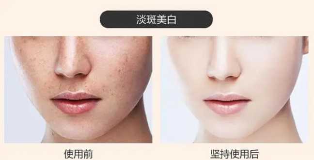 苦茶油美白 苦茶油美白