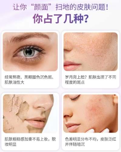 天然淡斑方法 天然淡斑方法