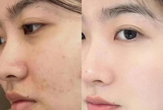 苦茶油美白 苦茶油美白