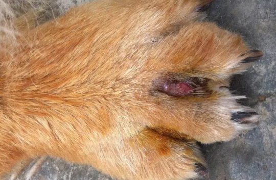 趾間炎症狀 趾間炎症狀