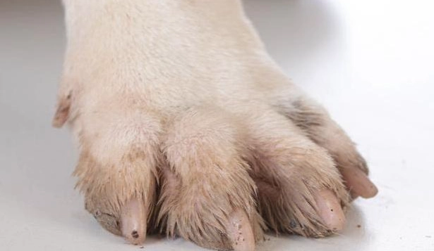 趾間炎症狀 趾間炎症狀