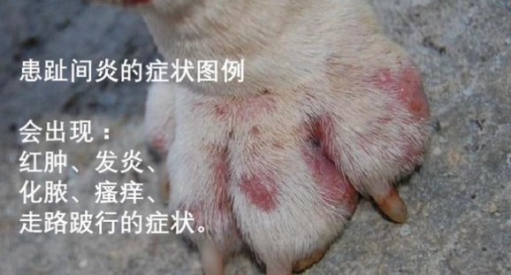 趾間炎治療 趾間炎治療