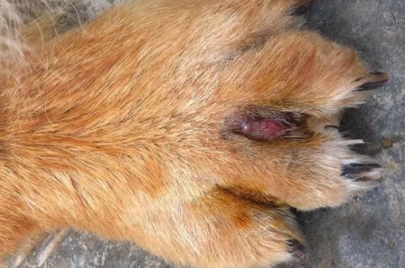 趾間炎治療 趾間炎治療