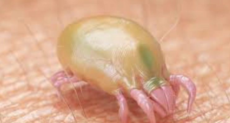 疥蟲感染症狀 疥蟲感染症狀