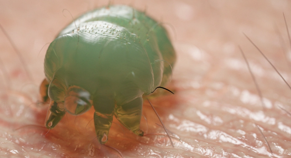 疥蟲如何消滅？徹底根除疥蟲的完整指南與實用技巧