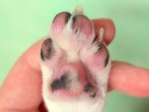 趾間炎症狀 趾間炎症狀