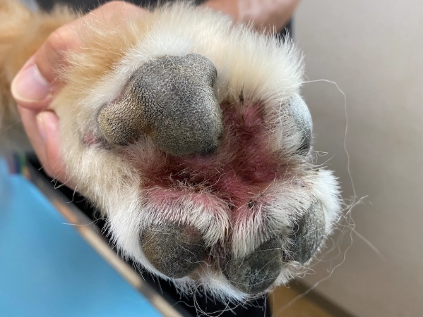 趾間炎症狀 趾間炎症狀