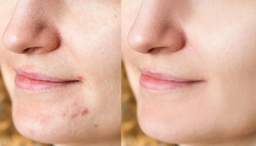 椰子油過敏治療