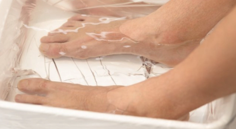 香港腳治療 香港腳治療