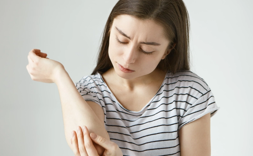 貓癬症狀 貓癬症狀