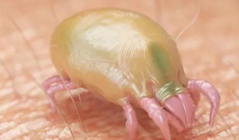 疥蟲防治技巧 疥蟲防治技巧